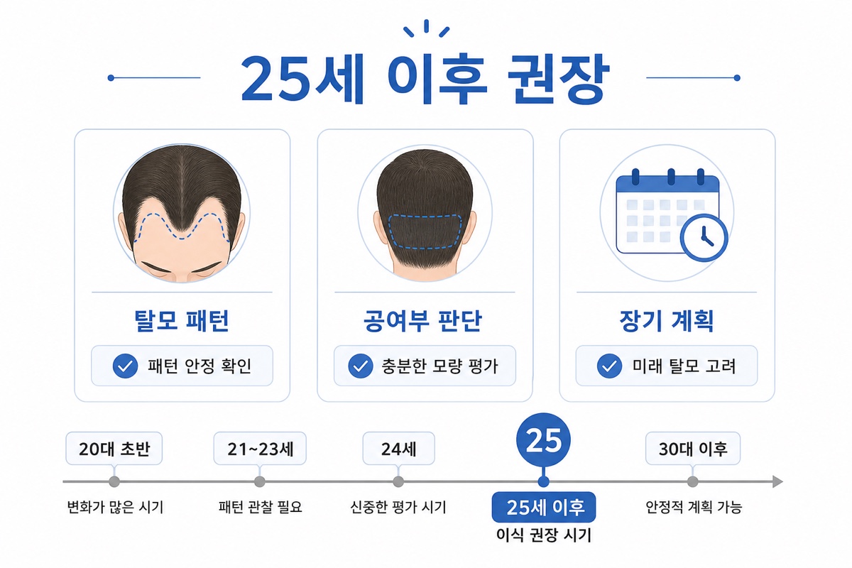 모발이식 25세 이후 권장 이유 인포그래픽