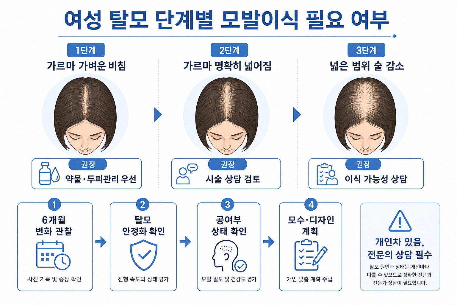 여성 탈모 단계별 모발이식 필요 여부 판단 기준
