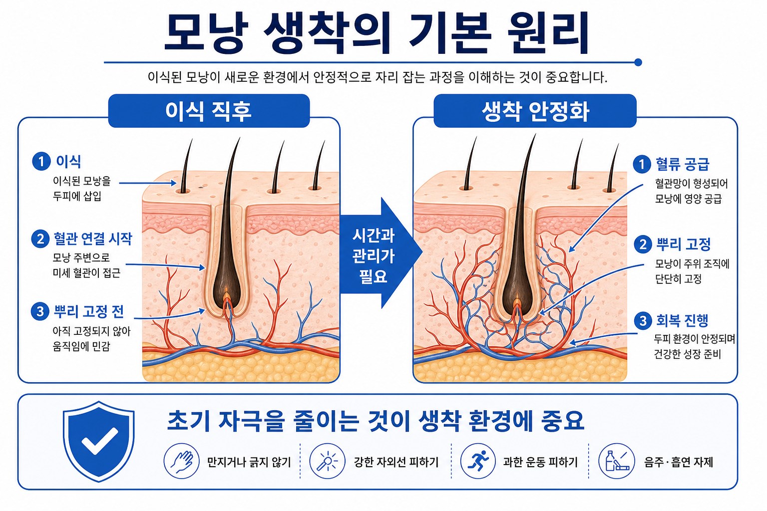 모발이식 생착 과정 개념 설명 인포그래픽