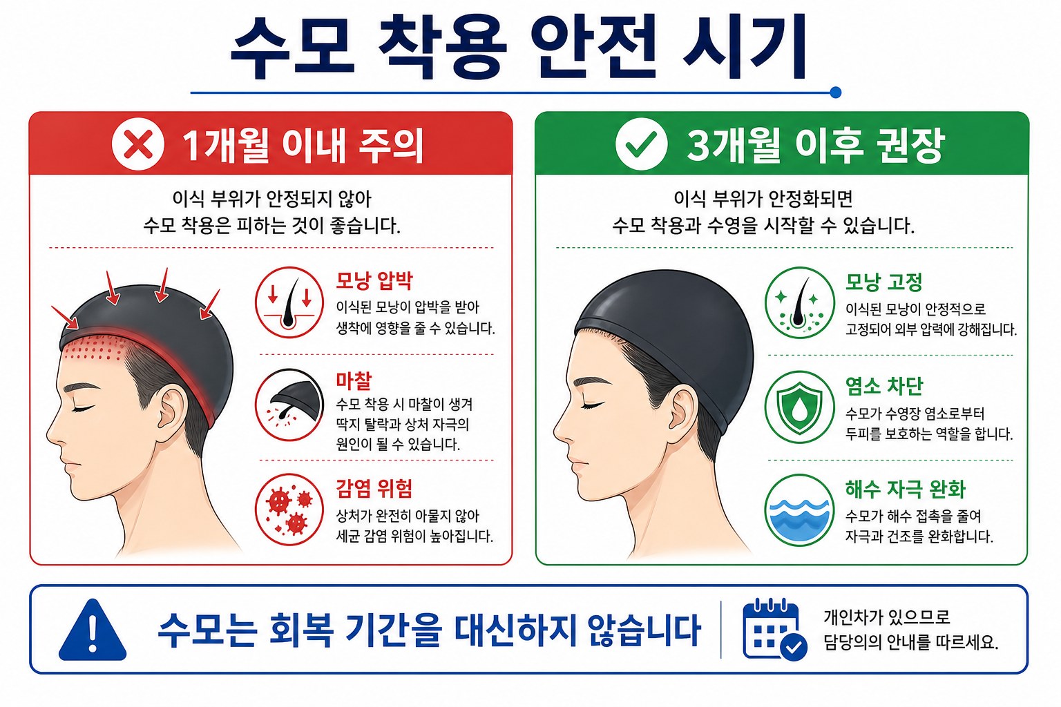 모발이식 후 수영모 착용 시기 안내 인포그래픽