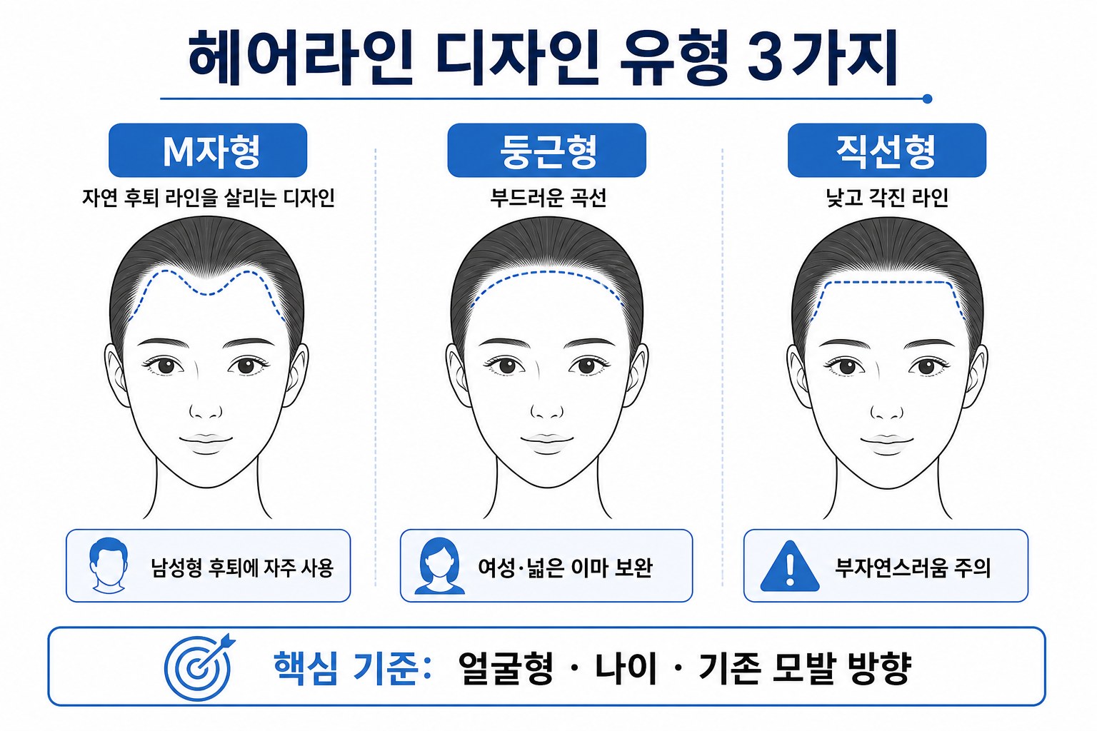 헤어라인 디자인 유형 M자 둥근형 직선형 비교 인포그래픽