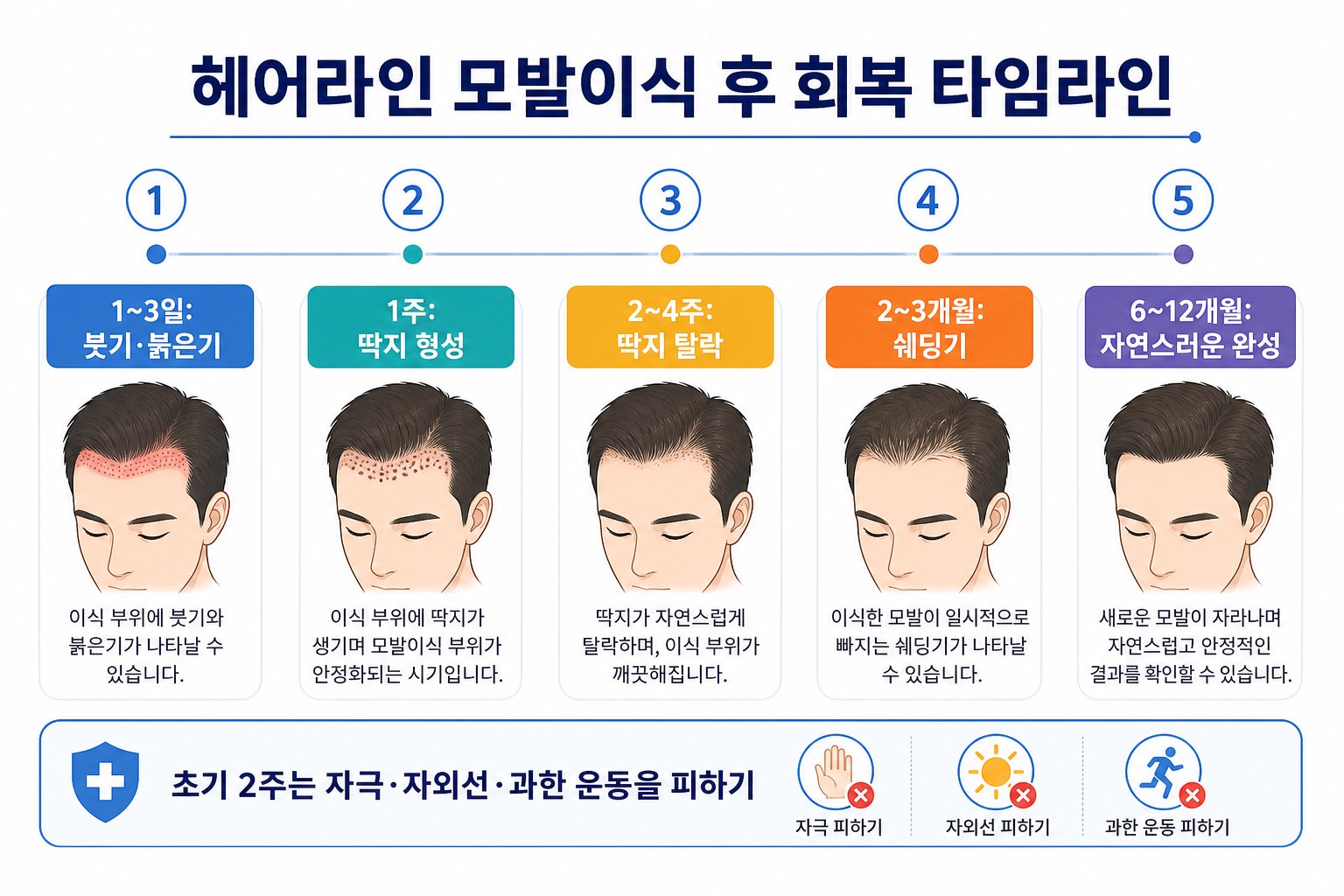 헤어라인 모발이식 수술 후 회복 타임라인 인포그래픽