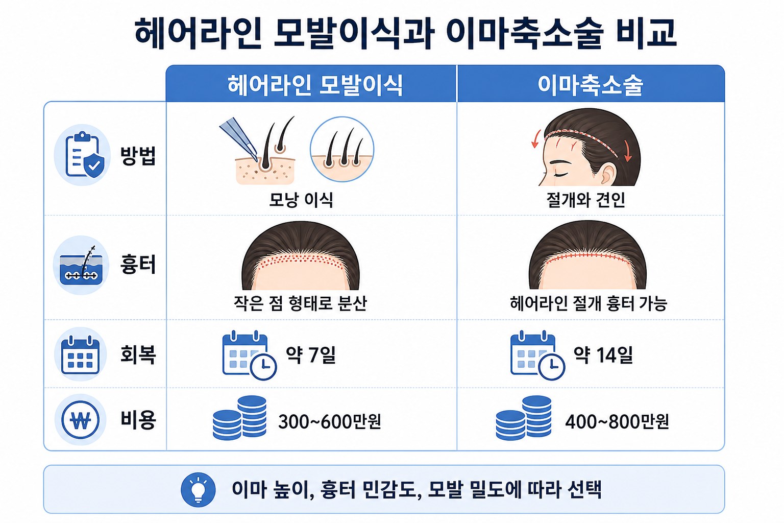 이마축소술과 헤어라인 모발이식 핵심 차이 비교표 인포그래픽