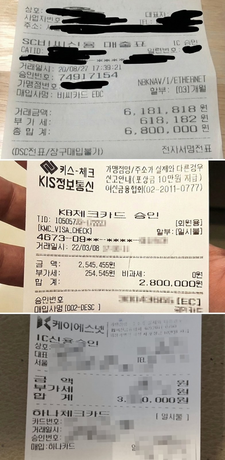 모발이식 수술비 카드 영수증