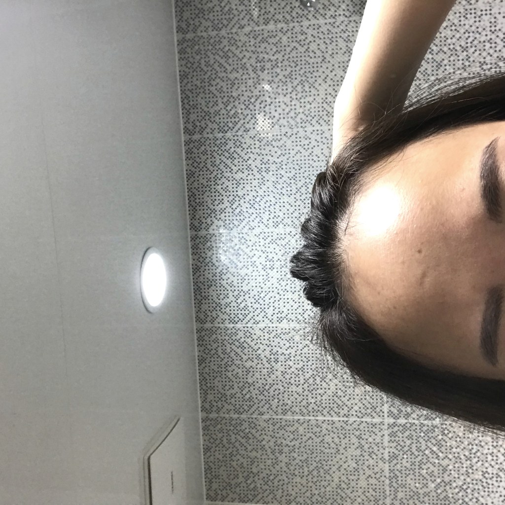 같은 사람의 한 달 뒤 이마 라인 상태