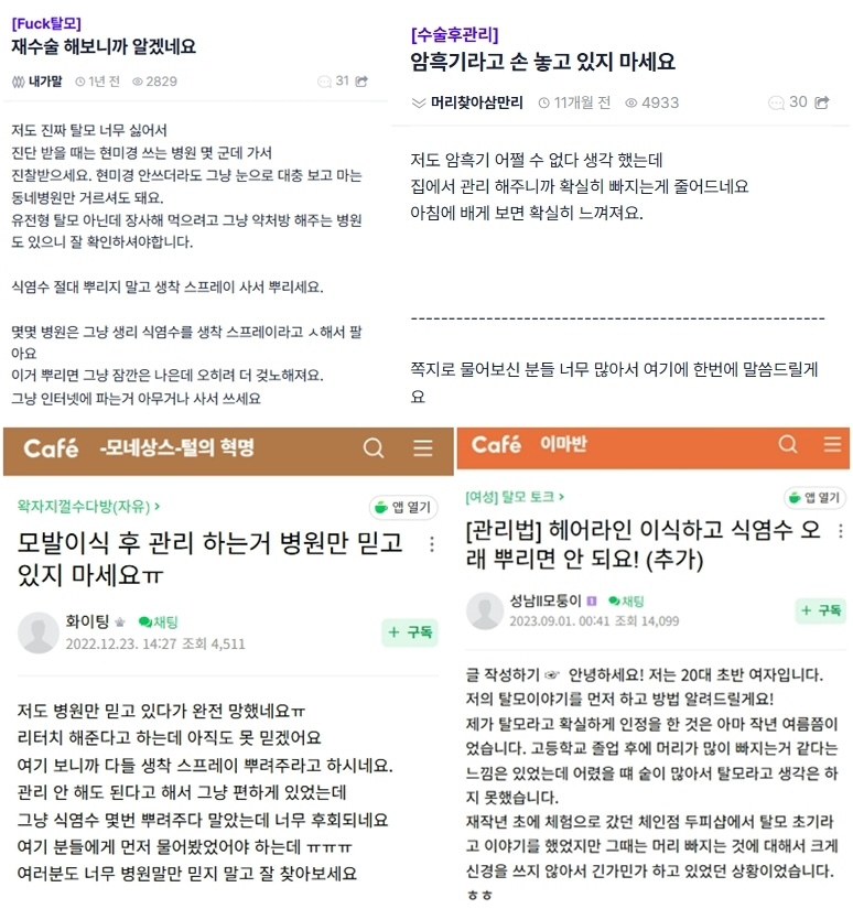 모발이식 커뮤니티에 올라온 수술 후 관리 관련 글